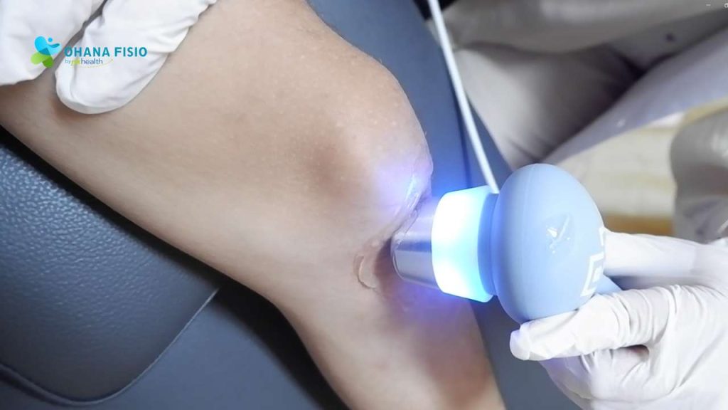 Berapa Lama Cedera Jumper's Knee Sembuh?