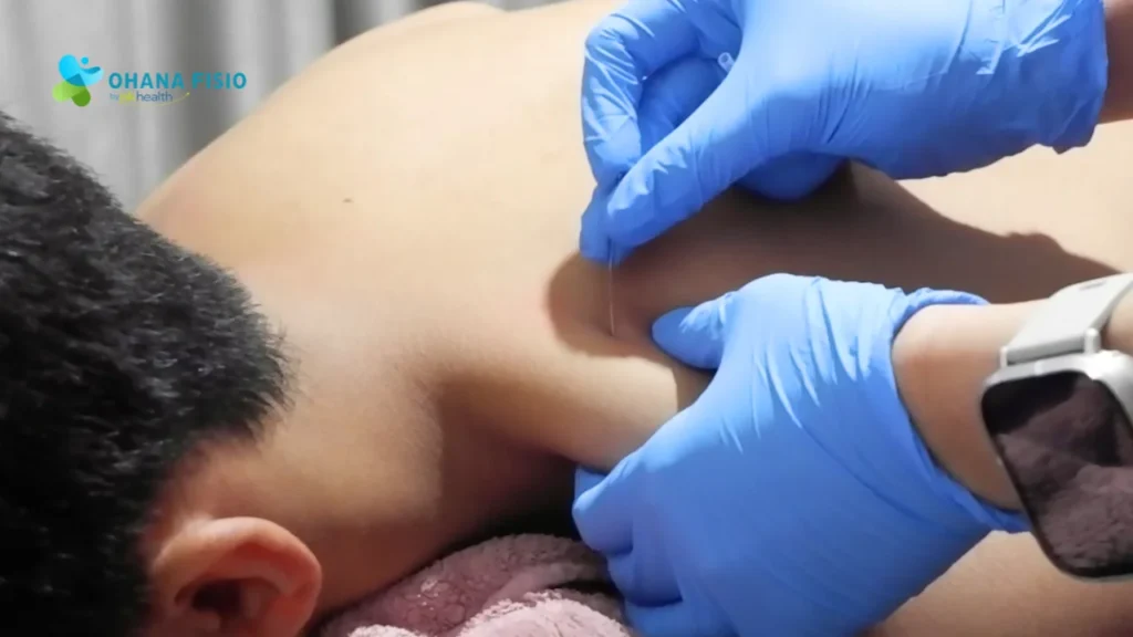 Cara Mengatasi Leher Belakang Sakit dan Kaku