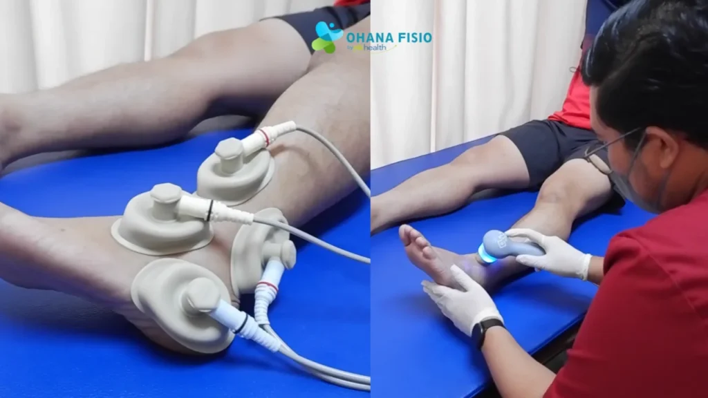 Penanganan Cedera Engkel agar Cepat Sembuh